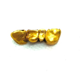 金歯
