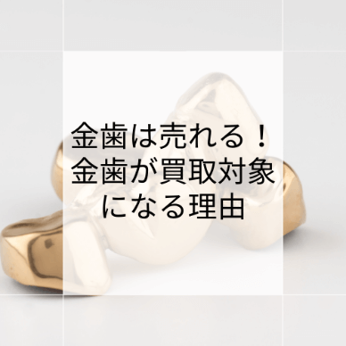 金歯は売れる！金歯が買取対象になる理由や1円でも高く売る方法
