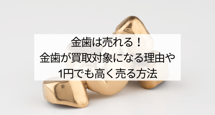 金歯は売れる!金歯が買取対象になる理由や1円でも高く売る方法